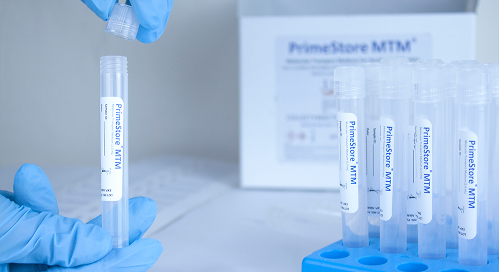 EKF's PrimeStore MTM, the only FDA Class 2 cleared product for microbial nucleic acid storage and stabilization.